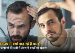 29 की उम्र में ही झड़ रहे हैं बाल? 5.6 लाख पुरुषों की स्टडी ने खोला असली राज