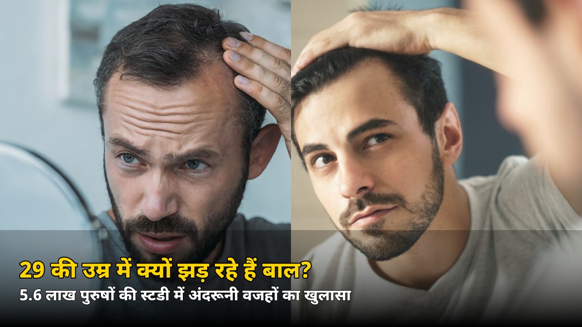 29 की उम्र में ही झड़ रहे हैं बाल? 5.6 लाख पुरुषों की स्टडी ने खोला असली राज