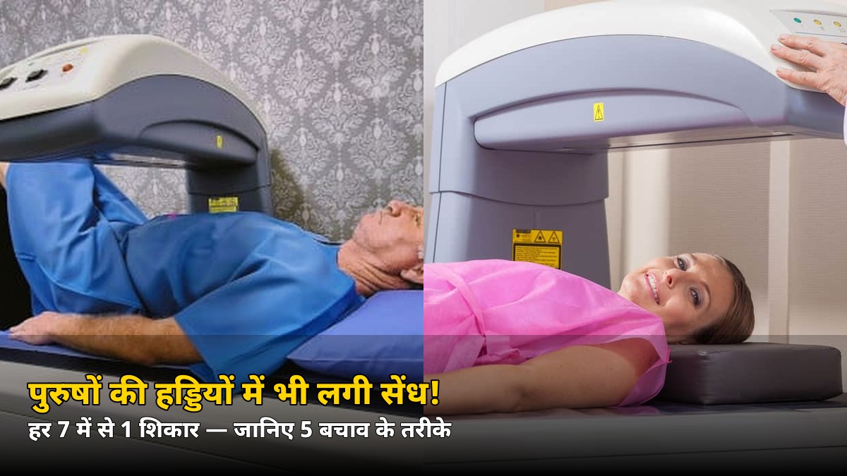 पुरुषों में भी ऑस्टियोपोरोसिस का खतरा! हर 7 में से 1 शख्स शिकार — जानिए बचाव के 5 तरीके
